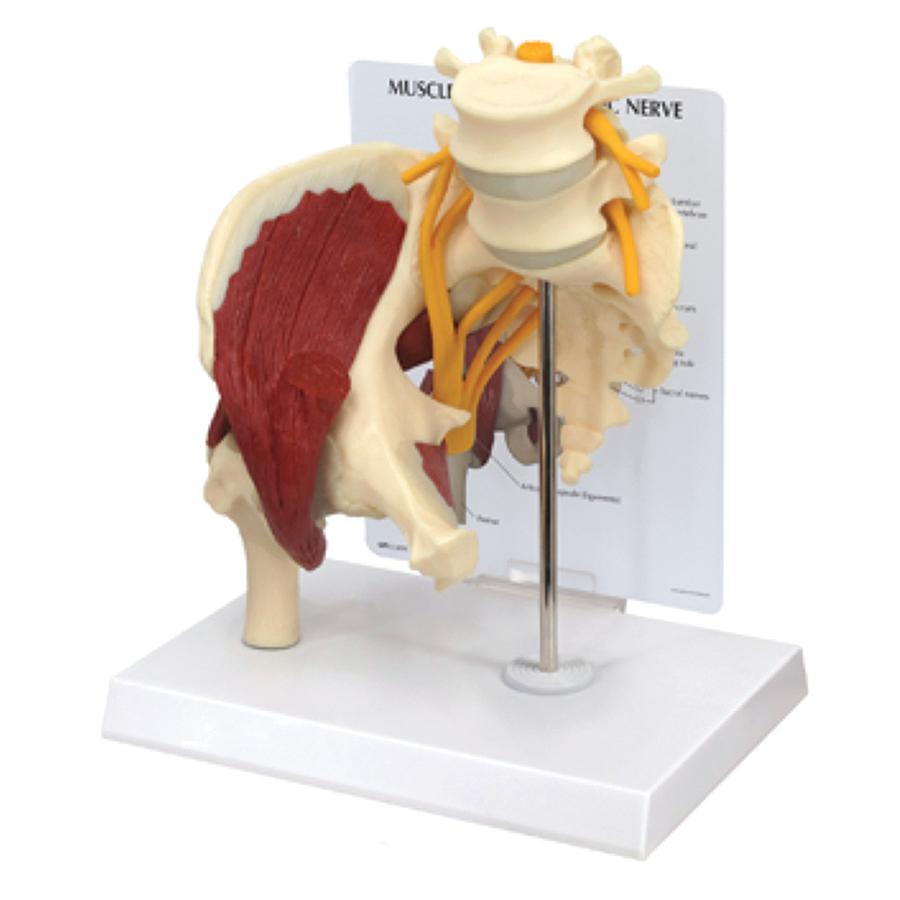 Muscled Hip With Sciatic Nerve