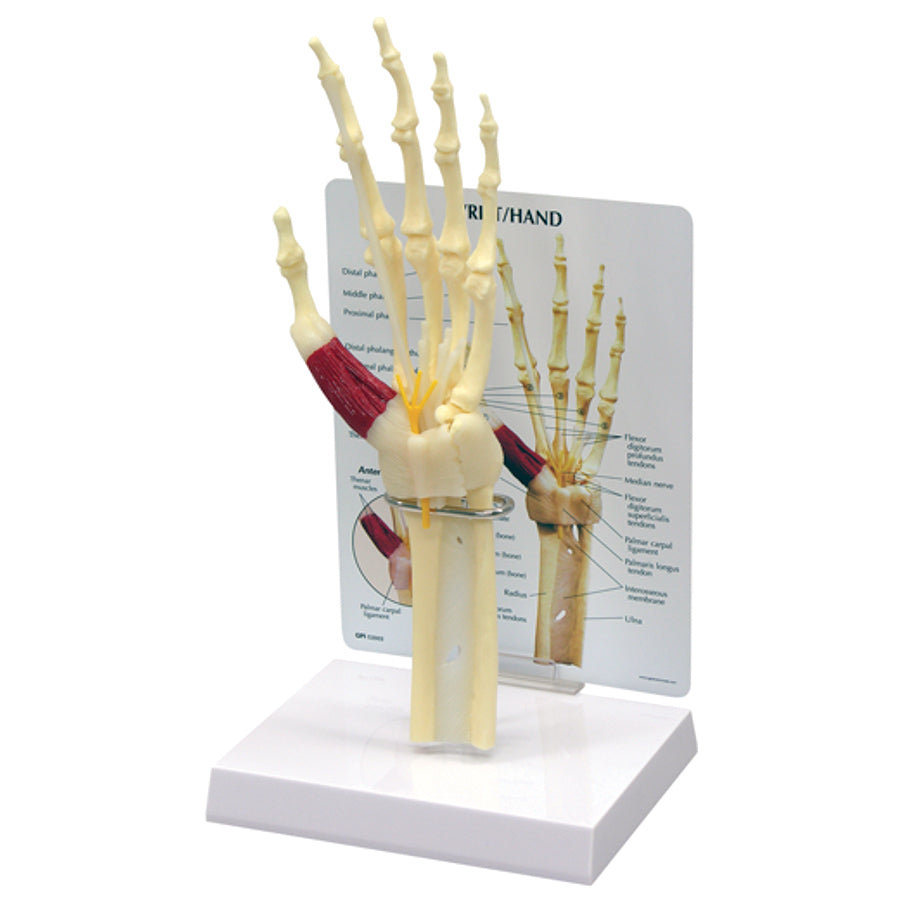 Hand/Wrist - Carpal Tunnel Syndrome