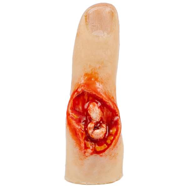 TraumaSim Finger Glove – Exposed Bone Injury