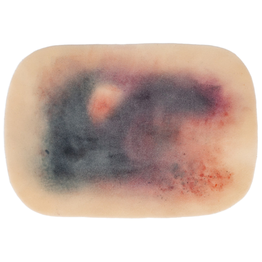 TraumaSim Self-Adhesive Large Haematoma